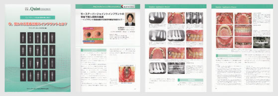 Quintessence DENTAL Implantology 2013年vol.20